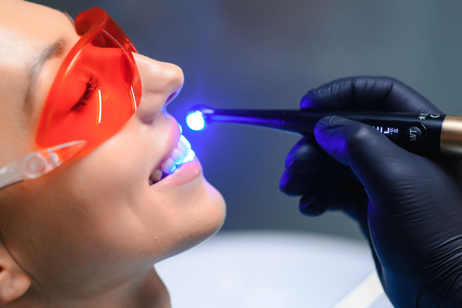 laser gum surgery in Hyderabad