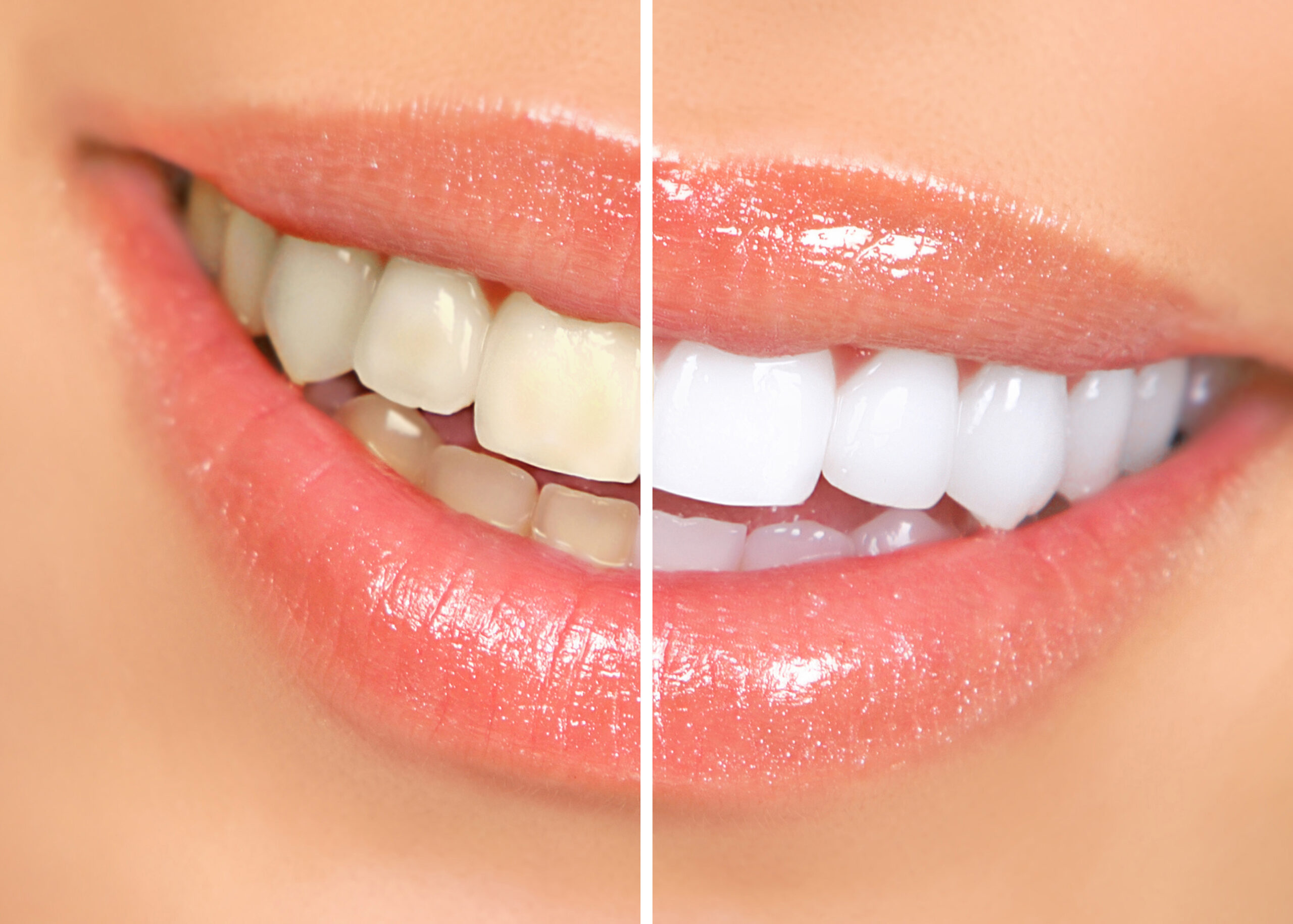 Cosmetic Dentistry in Saidabad ​