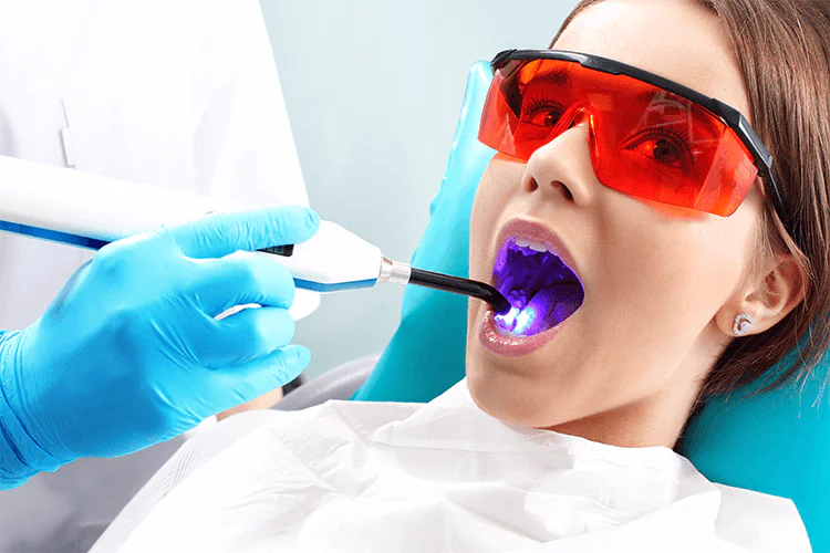 laser gum surgery in Hyderabad